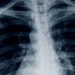 Imagen de una radiografía
